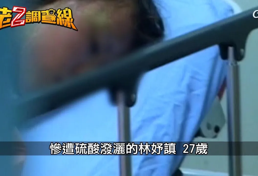 驚悚中山大學碩士潑酸案　求愛不成怒毀容美女學姊