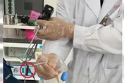 7cm水蛭鼻腔竄出！常冒「異物感、莫名出血」竟遭寄生　醫無奈：別再這樣洗臉