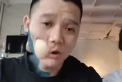 男子白點潰瘍疼痛、不癒合竟是口腔癌2期　術後戒檳榔、菸酒終於能吃滷肉飯