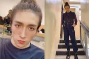 MIRROR舞者表演被爆頭！他戴頸箍「助頸椎生長」4周後取下　父曝「現實危機」：恐致肺炎