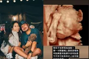 KID幸福曬「寶寶超音波照」！他見「這動作」笑了：兒子在對我加油啦~