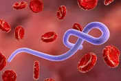 世紀病毒爆發！「無疫苗可預防」WHO籲各國做好應對措施：致死率50％！