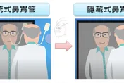 告別大象鼻子！安南醫院研發出「隱藏式鼻胃管」　堪稱鼻胃管界法拉利