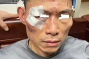 遭誤認通緝犯！警提10萬元和解金破局　三重挨揍男：要求汰除施暴惡警