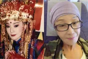 90％危險！70歲歌仔戲名旦連明月傳病危　明接受「換肝手術」已簽切結書