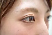 「左眼跳財、右眼跳災」？眼皮持續狂跳勿輕忽 超過2周恐有潛藏病因應就醫