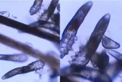 驚！蟎蟲入侵母女眼　竟是寵物惹的禍