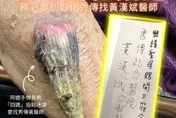 媽祖唯一指定！91歲嬤手臂長角　曝收「仙界轉診單」