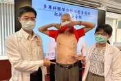 把握「食道癌」治療黃金期！臺中榮總多專科合作 患者第4日即可首次放化療！