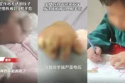 【影】心疼！女童用筷子戳插座致9根手指遭切除　病床上哭喊「不能畫畫了」