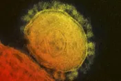 看球賽恐被「8種」病毒傳染病風險「包括MERS」　專家示警：避免接觸駱駝