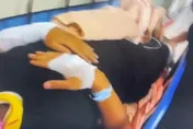 北市騎士自摔送醫！鼻子白白的被驗出這反應…這下糟了