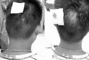 下手也太狠！誤踩同學眼鏡遭手機砸破頭　家長不捨：「道歉了還一直打」