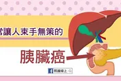 癌王胰臟癌新藥三期數據 杏國將登歐洲腫瘤學會