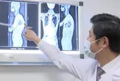 身高180突縮水10公分…他背後「有駝峰」無法躺平　醫一看驚：罹罕病