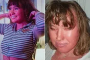 嫩妹患罕病「皮膚像魚鱗」　飽受歧視遭譏「番茄」：妳不該活著！