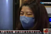 影/太玄宮執事自稱「被揮掉眼鏡」　臉上傷痕是被刮傷而非打傷