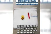 2歲幼童誤將黃豆塞入鼻10多天　醫師取出「竟然悄悄發芽了」