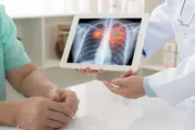 婦腰痛就醫檢查才知罹「肺癌末期」！一查驚見7手足「4人罹癌」
