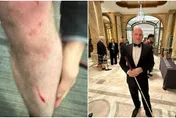 超猛！英國盲人記者下班遭搶　瞬間反擊制服歹徒還嗆：「你挑錯人了」
