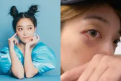 明星羽球隊賽遭K！貝童彤「眼周紅腫、瘀青」曝傷勢：水逆是不是…