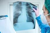 7歲女童拿「防曬噴霧」噴臉！狂咳送醫已「白肺」嚴重恐危及生命