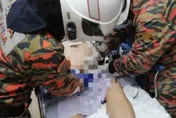 戒指卡陰莖！男子急入院求救要消防「增援」！網民：戴錯地方？