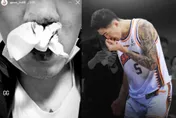 搶籃板爆鮮血！劉錚撞隊友鼻梁骨折　近日返台開刀