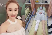 許聖梅拿大包小包慘摔「緊急送醫」！無奈揭「軟骨碎兩半」　躺床苦嘆：朋友全跑光