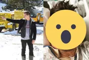「鷹眼」遭鏟雪車碾過腿！親曝近況「30根骨頭斷了」　市長揭英勇受傷真相