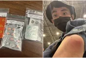 除夕睡醒「手肘腫一大包」！阿滴取消出國急就醫…33歲「竟罹這病」他哀吐緣由