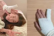 女網紅除夕玩心臟病急速一戳「小指歪了」送醫　本人揭傷勢：樂極生悲！