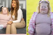 5歲就44公斤！英國女童罹罕病瘋狂爆吃　媽心累嘆：想把廚房上鎖