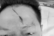 影/超慘！男逛新竹年貨大街遭電線絆倒撞頭縫10針　幼子也受傷市府急處理