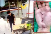 兇殘！瘋男稱「看到鬼」竟砍斷護理師手筋　辯精神異常失敗判12年