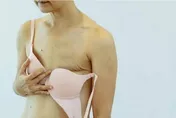 7旬婦下肢癱瘓竟是乳癌作祟！醫驚見「巨大乳房腫瘤」：癌細胞轉移到脊椎了