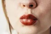 做完豐唇手術竟「腫脹到快爆炸」！18歲正妹腫成豬頭　網嚇歪：你哪位？