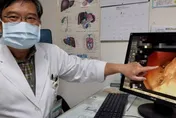 8旬翁出遊吃飽昏倒無呼吸心跳　醫一看傻眼「食道被塞滿」1小時才清完！