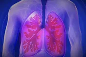 累累的以為沒睡飽？醫列「10大腎臟疾病症狀」：恐讓你持續腦霧、昏迷像感冒！