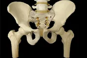 與死神拔河！七旬婦血癌又骨折　醫竟用「3D列印」手術成功！