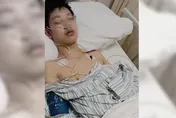 校外實習被安排「催繳卡費」　高職生壓力爆表吞電池自殘…1節小腸沒了