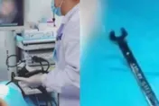 4歲小孩玩到沒得玩？將「這一工具」塞入爸爸體內　送醫治療