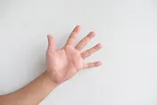 手腳掌黑痣越來越大竟是癌！黑色素瘤第四期生存率僅10%