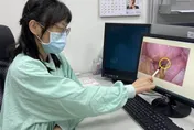 巧克力囊腫可能癌變！「這些人」是高危族群