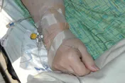 56歲中年男子下飛機腳腫到鞋子穿不下！送醫發現和心臟有關