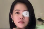 小S眼睛受傷「發瘋」！變身鬼滅、火影人物仿照連發　網笑：好中二
