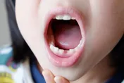 病毒流行季！小孩腸病毒嘴破吃不下　醫：開放「這些軟食物」應急