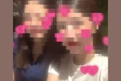 遭潑湯恐毀容！八大女「突曬自拍照」　美肌濾鏡蓋不掉傷疤