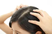 頭皮「滿天飛」好困擾！藥師警「5大NG行為」恐讓頭皮屑更多