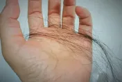 落髮好困擾！洗頭都掉一堆頭髮　營養師：強健髮質可從5類營養素下手